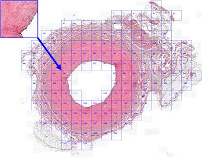 ML-driven segmentation of microvascular features during histological examination of tissue-engineered vascular grafts